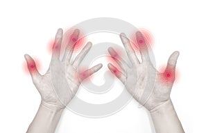 Finger joints inflammation. Concept of rheumatic arthritis, imgrating polyarthritis or arthralgia
