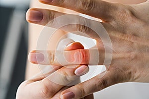 Finger Knuckle Hand Joint Pain photo