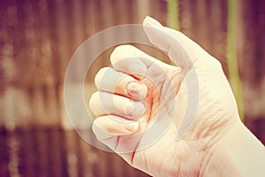 Finger with onychomycosis. A toenail fungus.. - soft focus photo