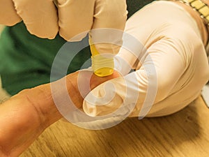 Finger-prick blood test in clinic