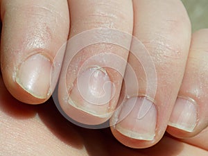 Fingernails from close up