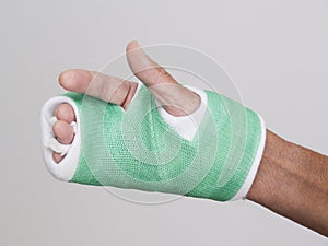 Fingers of right hand in green cast