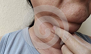 The fingers squeezing the wattle under the chin, cellulite and flabby skin under the neck.