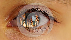 Fire in Human Eye