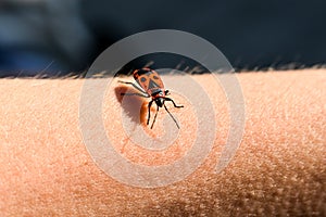 firebug on goosebumps skin