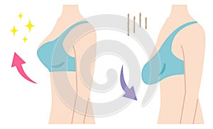 Firm and sagging breasts illustration. womenâ€™s beauty body care concept