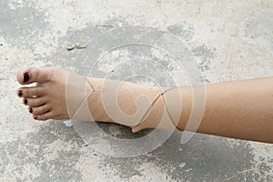 First aid accident wrist with liniment