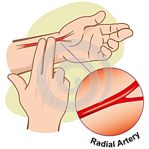 First Aid illustration person measuring pulse by Artery Radial