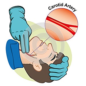 First Aid illustration person measuring pulse through the carotid artery with gloves