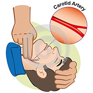 First Aid person measuring pulse through the carotid artery to watch