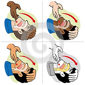 First Aid person opening the mouth clearing airway, ethnicities