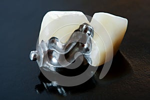 Fixed part of a prosthesis