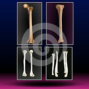 Leg Bones - Healthcare - Science - Medical Treatment - Organ photo