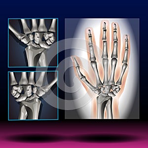 Wrist Anatomy - Human Body - Science - Healthcare photo