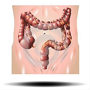 Anatomy of the Large Intestine colon - Cecum, Colon, Rectum, Anal Canal on white background photo