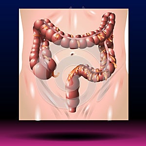 Anatomy of the Large Intestine colon - Cecum, Colon, Rectum, Anal Canal photo