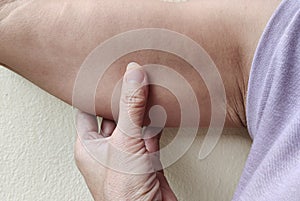 The flabbiness adipose sagging skin under the arm, cellulite and dark spots.