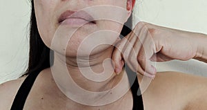 The Flabbiness adipose sagging skin under the neck, wrinkles and flabby skin under the chin, neck wattle of the woman.