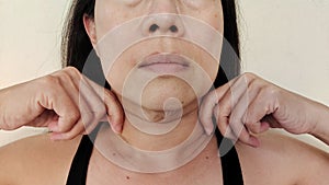 The Flabbiness adipose sagging skin under the neck, wrinkles and flabby skin under the chin, neck wattle of the woman.