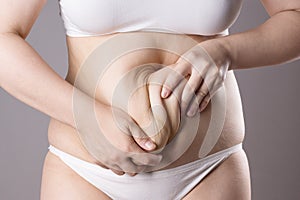 Flabby belly after pregnancy, overweight female body on gray background