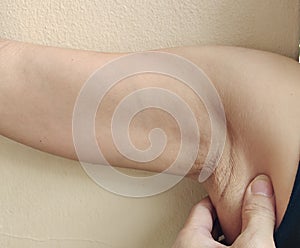 The Flabby sagging wrinkles and armpit hair underarm