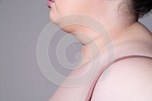 Flabby skin on the neck of an fat woman, female double chin on gray background