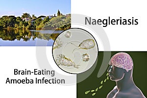 Flagellate form of the parasite Naegleria fowleri