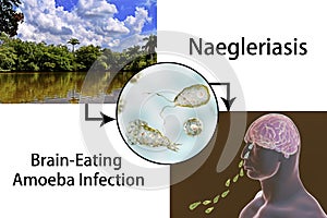 Flagellate form of the parasite Naegleria fowleri