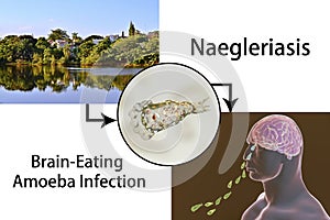 Flagellate form of the parasite Naegleria fowleri