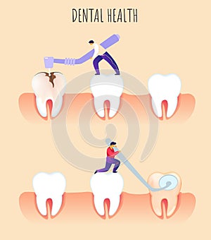 Flat Banner Dental Health Prevention Dentistry. photo