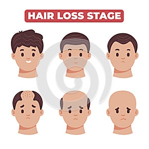 Flat-hand drawn hair loss stages collection Vector illustration.