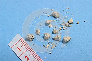 Flat lay or top view very small kidney stones with ruler at blue background