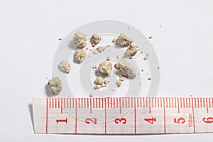 Flat lay or top view very small kidney stones with ruler at white background