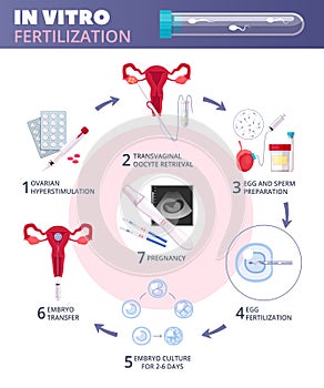 Flat In Vitro Fertilization IVF Infographics