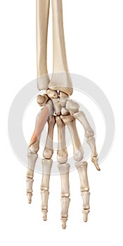 The flexor digiti minimi brevis