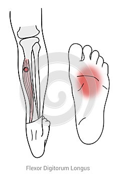 Flexor Digitorum Longus