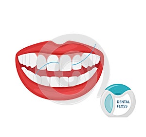 Flossing your teeth. Dental cleaning with dental floss. Oral hygiene. An open mouth with even white teeth. Aesthetic dentistry.