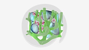 Fluid accumulation in Iymphatic tissue