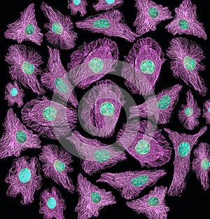 Fluorescence image of human cells with cytoskeletal microtubules and DNA