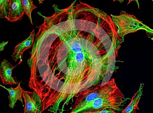 Fluorescence Microscope image of cells undergoing mitosis