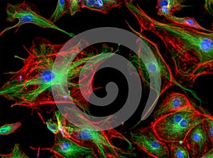 Fluorescence Microscope image of cells undergoing mitosis