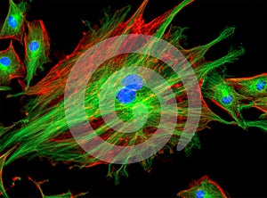 Fluorescence Microscope image of cells undergoing mitosis