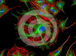 Fluorescence Microscope image of human cells undergoing mitosis