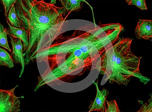 Fluorescence Microscope image of human cells undergoing mitosis