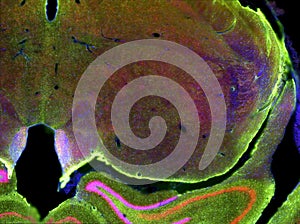 Fluorescence view of brain slice