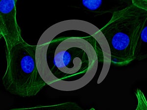 Fluorescent stem cells growing in culture showing microtubules in green and nucleus in blue photo