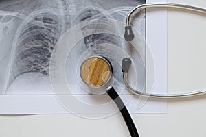 Fluorographic image of the lungs on paper and a stethoscope, healthy lungs of a man for a routine examination, health