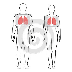 Fluorography. Chest x-ray. Vector illustration.