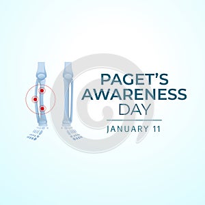 Flyers honoring Paget's Awareness Day