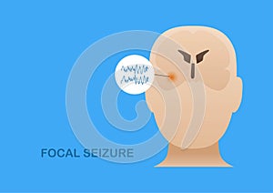 Focal seizure from temporal lobe